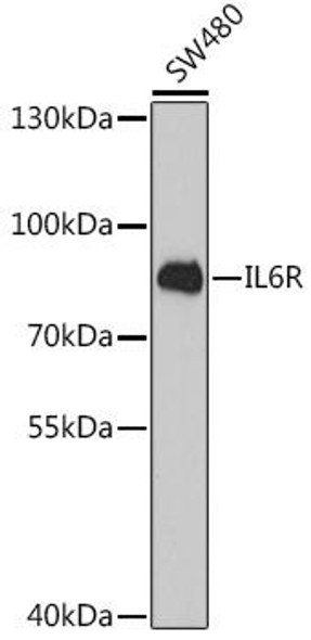 Cell Biology Antibodies 6 Anti-IL-6R Antibody CAB1570