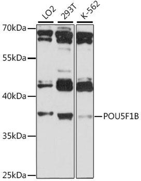 Epigenetics and Nuclear Signaling Antibodies 2 Anti-POU5F1B Antibody CAB15705