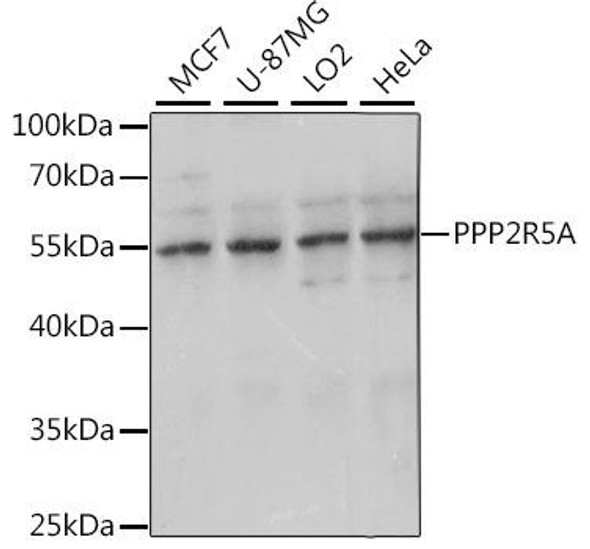 Cell Biology Antibodies 6 Anti-PPP2R5A Antibody CAB15706