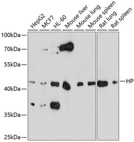 Immunology Antibodies 2 Anti-HP Antibody CAB1571