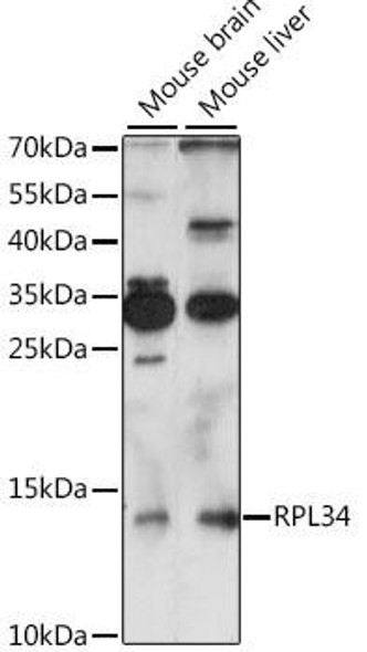 Epigenetics and Nuclear Signaling Antibodies 2 Anti-RPL34 Antibody CAB15716