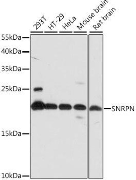 Cell Biology Antibodies 6 Anti-SNRPN Antibody CAB15726