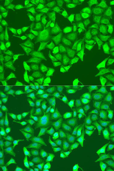 Cell Cycle Antibodies 1 Anti-AURKA Antibody CAB15728