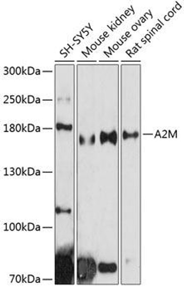 Cell Biology Antibodies 6 Anti-A2M Antibody CAB1573