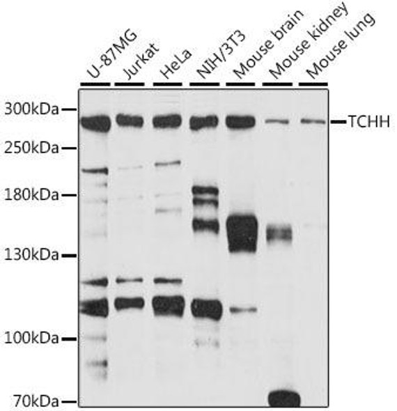 Cell Biology Antibodies 6 Anti-TCHH Antibody CAB15731