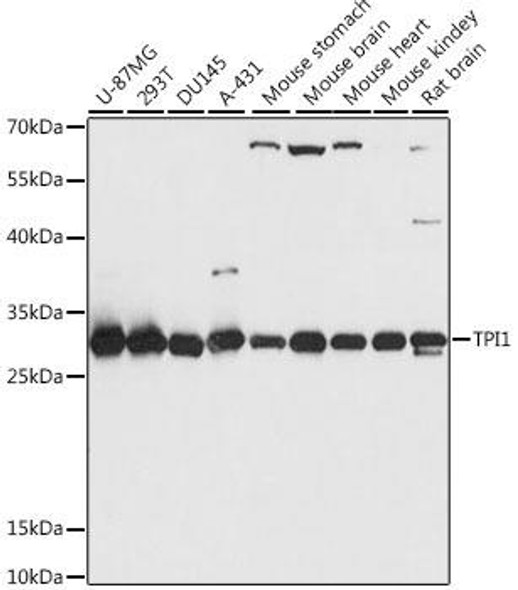 Metabolism Antibodies 1 Anti-TPI1 Antibody CAB15733