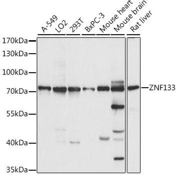 Epigenetics and Nuclear Signaling Antibodies 2 Anti-ZNF133 Antibody CAB15738