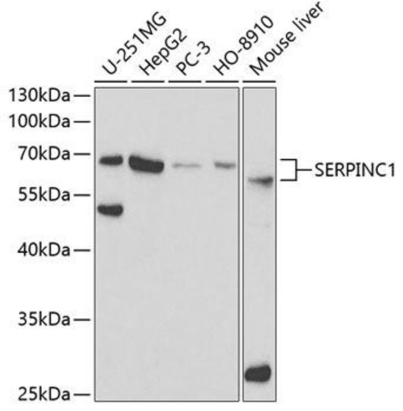 Cardiovascular Antibodies Anti-SERPINC1 Antibody CAB1574