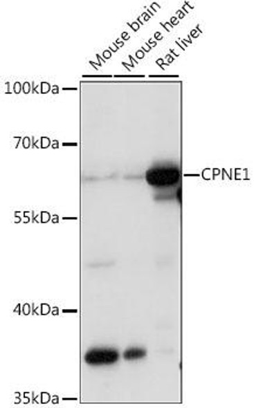 Developmental Biology Anti-CPNE1 Antibody CAB15749