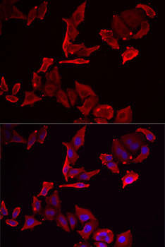 Immunology Antibodies 2 Anti-SKAP2 Antibody CAB15750