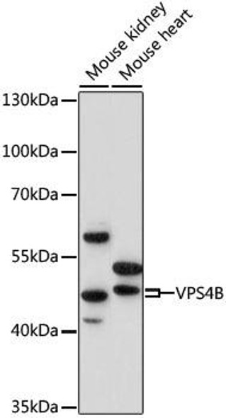 Cell Cycle Antibodies 1 Anti-VPS4B Antibody CAB15758