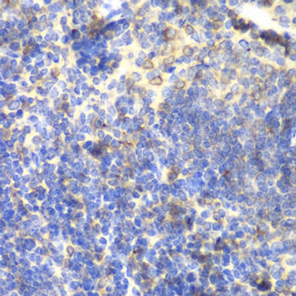 Immunology Antibodies 2 Anti-BTK Antibody CAB1576