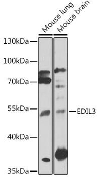 Cell Biology Antibodies 6 Anti-EDIL-3 Antibody CAB15772