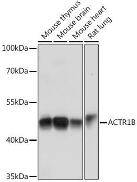 Cell Biology Antibodies 6 Anti-ACTR1B Antibody CAB15773