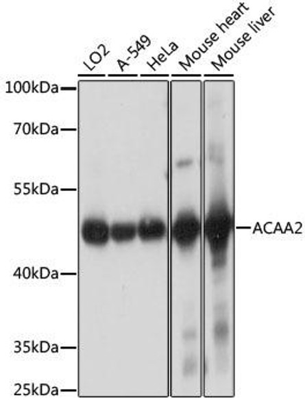 Metabolism Antibodies 3 Anti-ACAA2 Antibody CAB15778