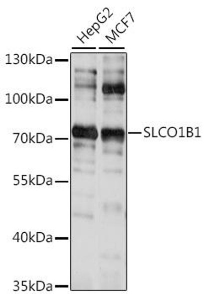 Signal Transduction Antibodies 2 Anti-SLCO1B1 Antibody CAB15783