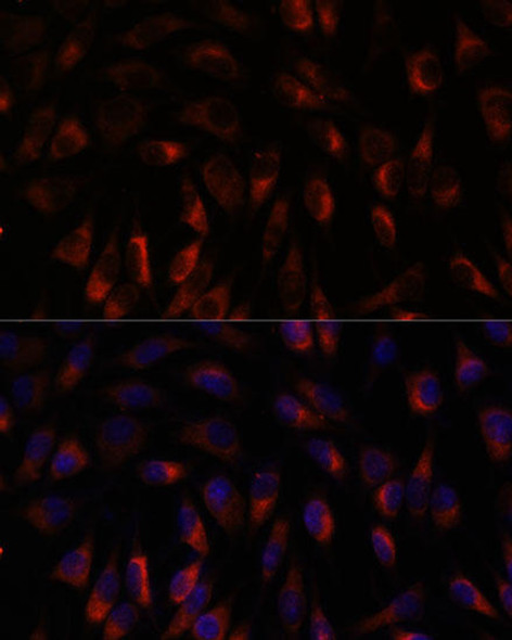 Cell Biology Antibodies 6 Anti-CHP1 Antibody CAB15791