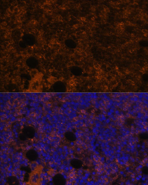 Cell Biology Antibodies 6 Anti-CD11B Antibody CAB1581