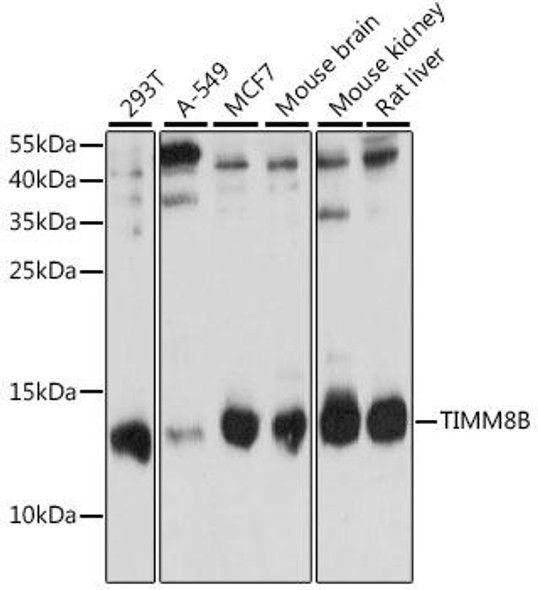 Cell Biology Antibodies 6 Anti-TIMM8B Antibody CAB15814