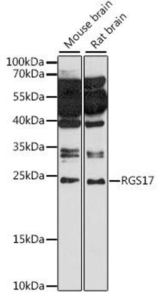 Cell Biology Antibodies 6 Anti-RGS17 Antibody CAB15815