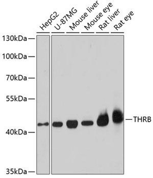Epigenetics and Nuclear Signaling Antibodies 2 Anti-THRB Antibody CAB1582