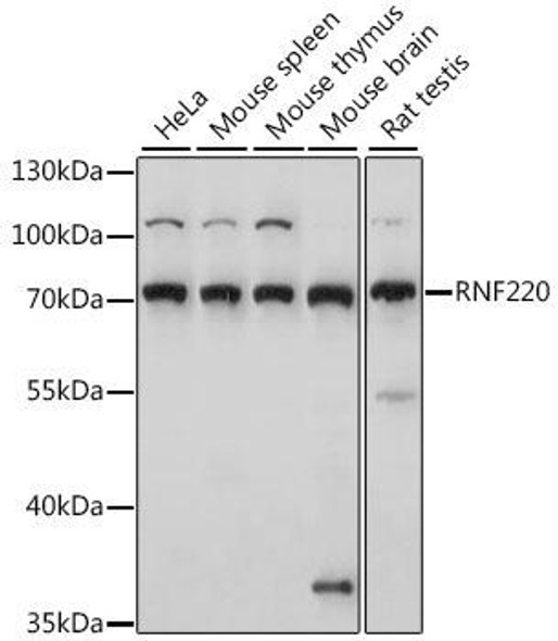Signal Transduction Antibodies 2 Anti-RNF220 Antibody CAB15853
