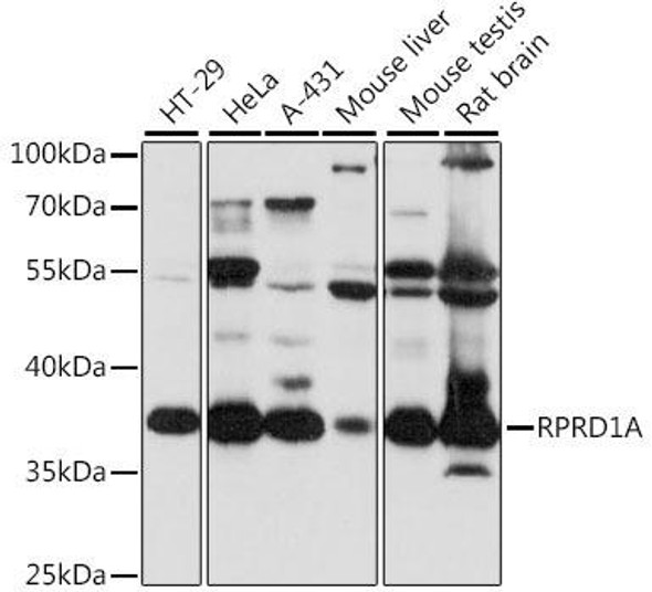 Cell Biology Antibodies 6 Anti-RPRD1A Antibody CAB15854