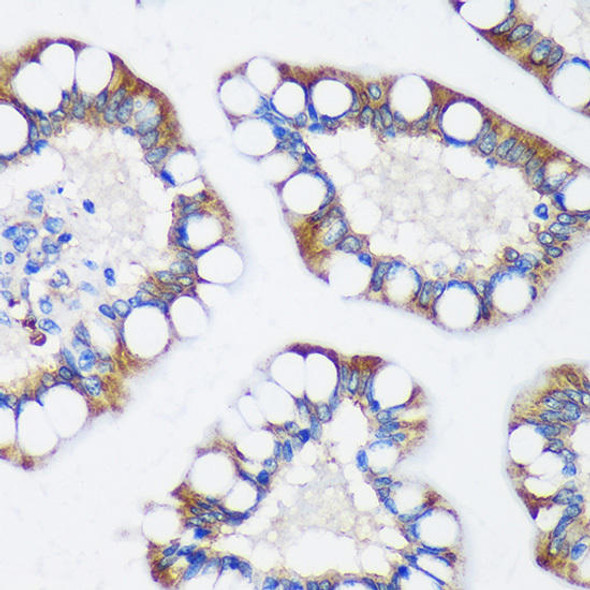 Signal Transduction Antibodies 2 Anti-TRIM62 Antibody CAB15855