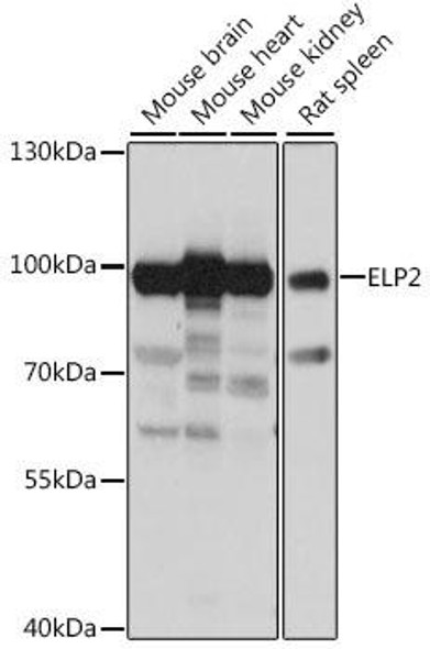 Epigenetics and Nuclear Signaling Antibodies 2 Anti-ELP2 Antibody CAB15857