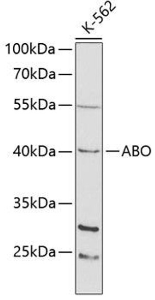 Cell Biology Antibodies 6 Anti-ABO Antibody CAB1586