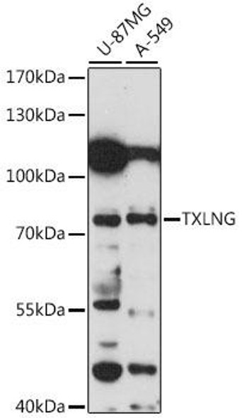 Cell Cycle Antibodies 1 Anti-TXLNG Antibody CAB15865