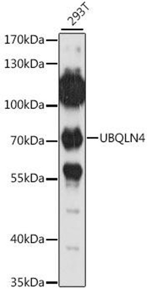 Autophagy Antibodies Anti-UBQLN4 Antibody CAB15869