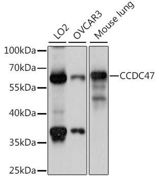 Cell Biology Antibodies 6 Anti-CCDC47 Antibody CAB15871