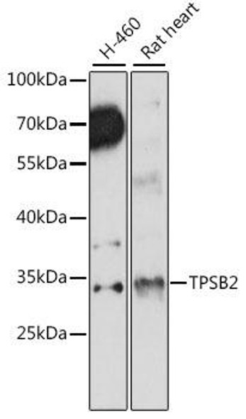 Immunology Antibodies 2 Anti-TPSB2 Antibody CAB15887