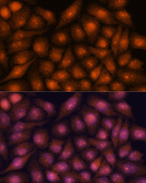 Epigenetics and Nuclear Signaling Antibodies 2 Anti-DDX31 Antibody CAB15892