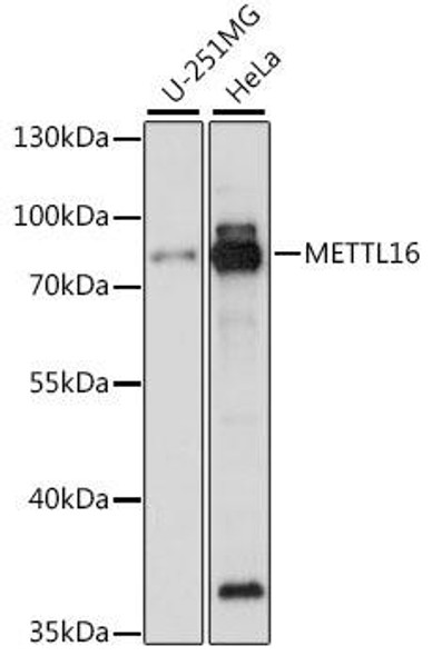 Cell Biology Antibodies 6 Anti-METTL16 Antibody CAB15894