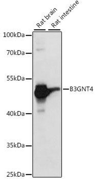 Cell Biology Antibodies 6 Anti-B3GNT4 Antibody CAB15896