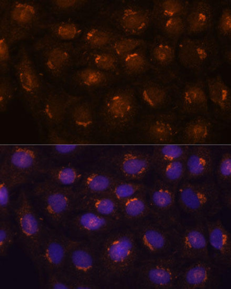 Cell Biology Antibodies 6 Anti-B3GNT4 Antibody CAB15896