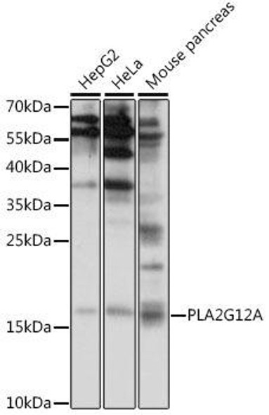 Metabolism Antibodies 3 Anti-PLA2G12A Antibody CAB15902