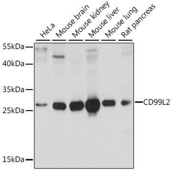 Cell Biology Antibodies 6 Anti-CD99L2 Antibody CAB15907