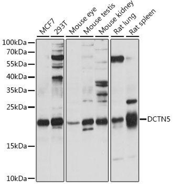 Cell Biology Antibodies 6 Anti-DCTN5 Antibody CAB15915