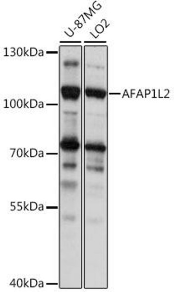 Cell Biology Antibodies 6 Anti-AFAP1L2 Antibody CAB15916