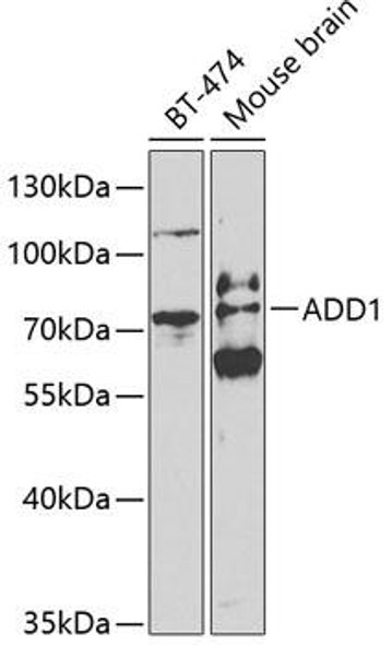 Cell Biology Antibodies 6 Anti-ADD1 Antibody CAB1592