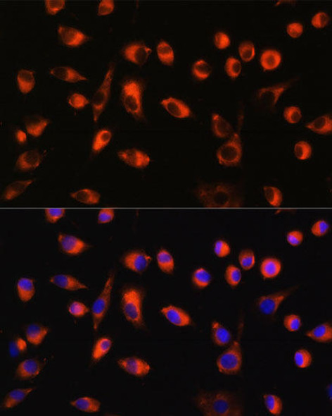 Cell Biology Antibodies 6 Anti-TMEM44 Antibody CAB15929