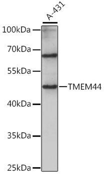 Cell Biology Antibodies 6 Anti-TMEM44 Antibody CAB15932