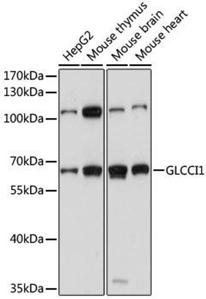 Cell Biology Antibodies 6 Anti-GLCCI1 Antibody CAB15934