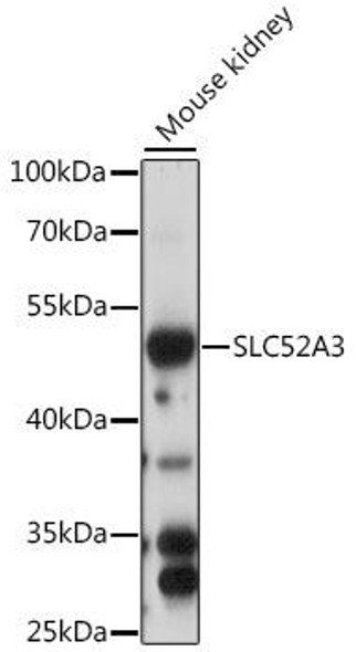 Signal Transduction Antibodies 2 Anti-SLC52A3 Antibody CAB15935