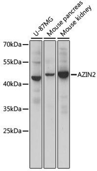 Metabolism Antibodies 3 Anti-AZIN2 Antibody CAB15936