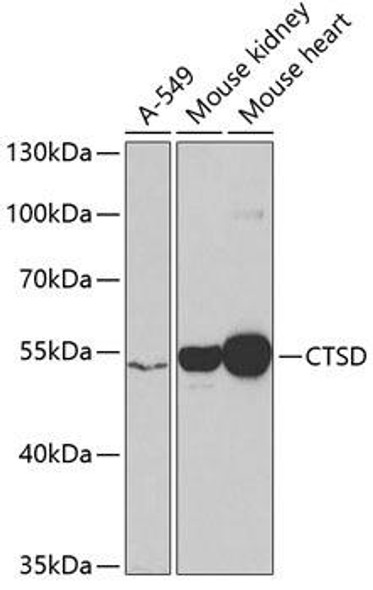 Cell Biology Antibodies 6 Anti-CTSD Antibody CAB1594