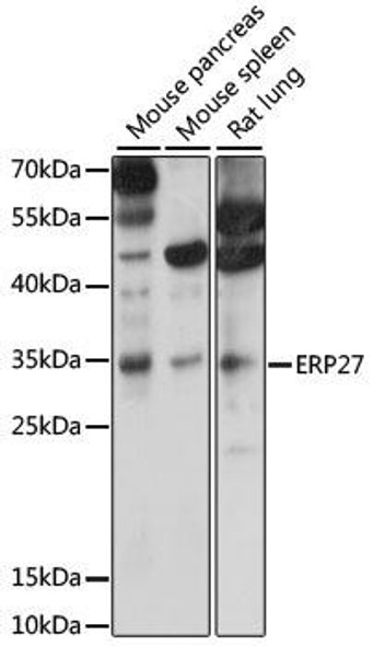Signal Transduction Antibodies 2 Anti-ERP27 Antibody CAB15944